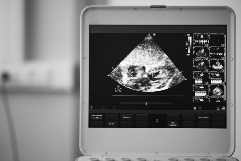 The Vital Role of Veterinary Ultrasound Machines in Advancing Animal Care